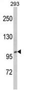 CTD Phosphatase Subunit 1 antibody, AP17253PU-N, Origene, Western Blot image 