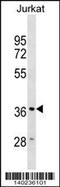 Heme Oxygenase 2 antibody, 60-469, ProSci, Western Blot image 