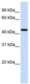 Coagulation Factor II Thrombin Receptor antibody, TA339927, Origene, Western Blot image 