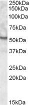 Unc-5 Family C-Terminal Like antibody, EB08671, Everest Biotech, Western Blot image 