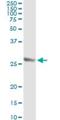 Twist Family BHLH Transcription Factor 1 antibody, H00007291-M01, Novus Biologicals, Immunoprecipitation image 