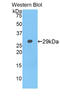 Neurofascin antibody, LS-C295575, Lifespan Biosciences, Western Blot image 