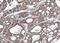 Adenylate Kinase 4 antibody, GTX104430, GeneTex, Immunohistochemistry paraffin image 