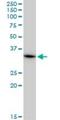 Mitochondrial Ribosomal Protein L1 antibody, H00065008-M02, Novus Biologicals, Western Blot image 