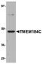 Transmembrane Protein 184C antibody, A15776, Boster Biological Technology, Western Blot image 