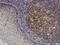 High Mobility Group Box 1 antibody, H00003146-M03, Novus Biologicals, Immunohistochemistry paraffin image 