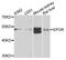 Erythropoietin Receptor antibody, A2917, ABclonal Technology, Western Blot image 