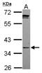 Phosphopantothenoylcysteine Synthetase antibody, NBP2-19811, Novus Biologicals, Western Blot image 