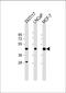 Protein Arginine Methyltransferase 6 antibody, A02924, Boster Biological Technology, Western Blot image 