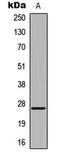 Homeobox A6 antibody, LS-C359016, Lifespan Biosciences, Western Blot image 