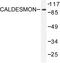 Caldesmon 1 antibody, LS-C176313, Lifespan Biosciences, Western Blot image 
