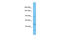 Glutamate Metabotropic Receptor 6 antibody, 27-642, ProSci, Western Blot image 