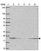 Interferon Induced Protein 44 Like antibody, PA5-63849, Invitrogen Antibodies, Western Blot image 