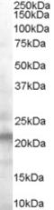 Vacuolar Protein Sorting 25 Homolog antibody, LS-C55671, Lifespan Biosciences, Western Blot image 