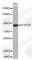 Signal Transducer And Activator Of Transcription 5A antibody, A0073, ABclonal Technology, Western Blot image 