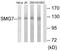 SMG7 Nonsense Mediated MRNA Decay Factor antibody, TA314983, Origene, Western Blot image 