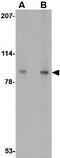 VPS53 Subunit Of GARP Complex antibody, GTX31341, GeneTex, Western Blot image 