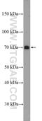 Signaling Lymphocytic Activation Molecule Family Member 1 antibody, 10949-2-AP, Proteintech Group, Western Blot image 