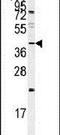 Serpin Family F Member 1 antibody, PA5-14200, Invitrogen Antibodies, Western Blot image 