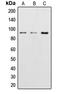 Catenin Beta 1 antibody, LS-C352121, Lifespan Biosciences, Western Blot image 