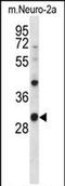 Casein Kinase 1 Alpha 1 antibody, PA5-71913, Invitrogen Antibodies, Western Blot image 