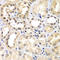 Zinc Finger Protein 264 antibody, LS-C349079, Lifespan Biosciences, Immunohistochemistry paraffin image 