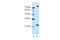 Frizzled Class Receptor 9 antibody, ARP41253_T100, Aviva Systems Biology, Western Blot image 