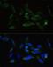 Transforming Growth Factor Beta Receptor 2 antibody, LS-C747135, Lifespan Biosciences, Immunofluorescence image 