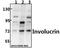 Involucrin antibody, A02628, Boster Biological Technology, Western Blot image 