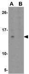 SPRY Domain Containing 4 antibody, GTX32023, GeneTex, Western Blot image 
