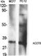 Acyl-CoA Thioesterase 8 antibody, A09392-1, Boster Biological Technology, Western Blot image 