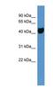 Olfactory receptor OR11-231 antibody, NBP1-68969, Novus Biologicals, Western Blot image 