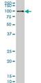 DNA Polymerase Kappa antibody, ab57070, Abcam, Western Blot image 