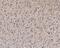 Phosphoinositide-3-Kinase Regulatory Subunit 1 antibody, A00318-1, Boster Biological Technology, Immunohistochemistry paraffin image 