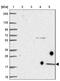 Glycosylphosphatidylinositol Anchored High Density Lipoprotein Binding Protein 1 antibody, NBP2-47445, Novus Biologicals, Western Blot image 