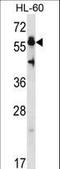 Heat Shock Transcription Factor 4 antibody, LS-C165047, Lifespan Biosciences, Western Blot image 
