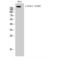 Erb-B2 Receptor Tyrosine Kinase 3 antibody, LS-C381776, Lifespan Biosciences, Western Blot image 