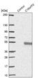 Chromosome 16 Open Reading Frame 70 antibody, PA5-59439, Invitrogen Antibodies, Western Blot image 