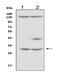 Insulin Like Growth Factor Binding Protein 5 antibody, A01952-1, Boster Biological Technology, Western Blot image 