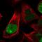 Holliday Junction Recognition Protein antibody, NBP2-58281, Novus Biologicals, Immunofluorescence image 