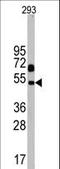 Neuronal Pentraxin 1 antibody, LS-C100842, Lifespan Biosciences, Western Blot image 