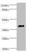 Galectin 9 antibody, A55214-100, Epigentek, Western Blot image 