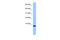 Transition Protein 1 antibody, A07804, Boster Biological Technology, Western Blot image 