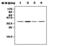 DNA Fragmentation Factor Subunit Beta antibody, MA5-17214, Invitrogen Antibodies, Western Blot image 