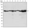 Coactivator Associated Arginine Methyltransferase 1 antibody, GTX80395, GeneTex, Western Blot image 