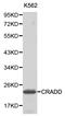 CASP2 And RIPK1 Domain Containing Adaptor With Death Domain antibody, LS-C192246, Lifespan Biosciences, Western Blot image 