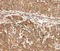 PDZ And LIM Domain 4 antibody, MBS2524532, MyBioSource, Immunohistochemistry paraffin image 