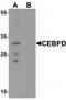 CCAAT Enhancer Binding Protein Delta antibody, TA319630, Origene, Western Blot image 