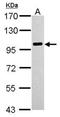 Phospholipase A2 Group IVA antibody, NBP1-31344, Novus Biologicals, Western Blot image 