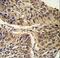 Chaperonin Containing TCP1 Subunit 3 antibody, LS-C168498, Lifespan Biosciences, Immunohistochemistry paraffin image 